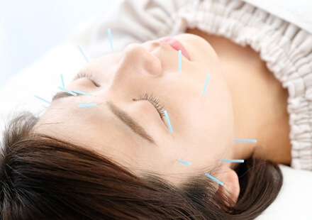 美容鍼 + 自律神経調整 + 顔・頭・リンパマッサージ